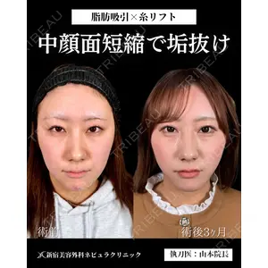 新宿美容外科ネビュラクリニック 山本 紘子医師の症例