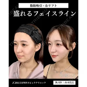 新宿美容外科ネビュラクリニック 山本 紘子医師の症例