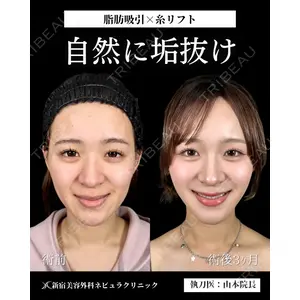 新宿美容外科ネビュラクリニック 山本 紘子医師の症例