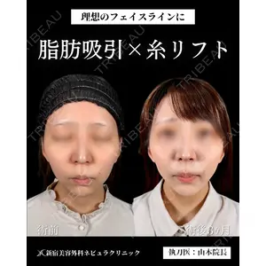新宿美容外科ネビュラクリニック 山本 紘子医師の症例