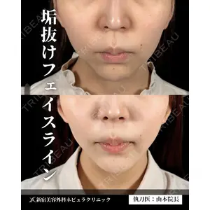 新宿美容外科ネビュラクリニック 山本 紘子医師の症例