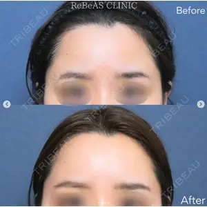 ReBeAS CLINICの症例