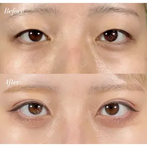R Beauty CLINIC 名古屋院 木村 尚大医師の症例