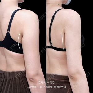 アリエル美容クリニック 横浜院 加藤 敏次医師の症例
