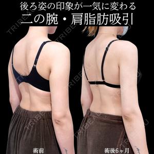 アリエル美容クリニック 横浜院 加藤 敏次医師の症例