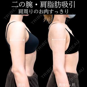 アリエル美容クリニック 横浜院 加藤 敏次医師の症例