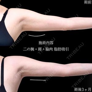 アリエル美容クリニック 大宮院の症例