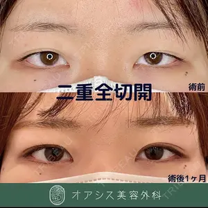 オアシス美容外科 遠藤 剛史医師の症例