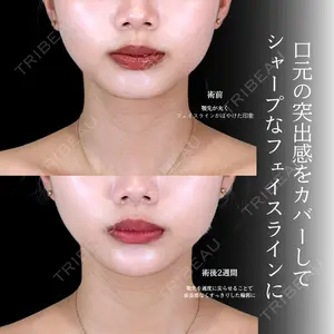 アリエル美容クリニック 横浜院 渡邉 光医師の症例