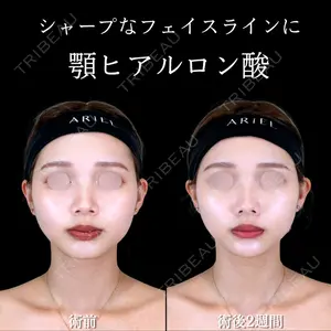 アリエル美容クリニック 横浜院 渡邉 光医師の症例