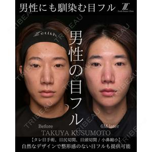 Zetith Beauty Clinic 大阪心斎橋院 楠本 拓哉医師の症例
