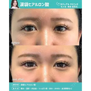 カジュアルクリニック 平塚院 藤家 里莉花医師の症例