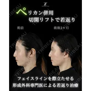 Zetith Beauty Clinic 新宿院 副島直人医師の症例