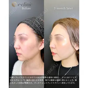 eクリニック 福岡院 伊藤 渉医師の症例