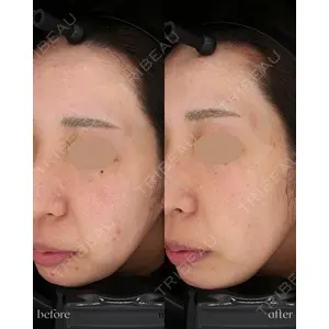 muni skin clinicの症例