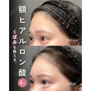 BITO BEAUTY CLINIC 伊藤 富良野医師の症例