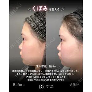 BITO BEAUTY CLINIC 伊藤 富良野医師の症例