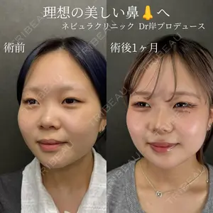 ネビュラクリニック 京都院 岸 大輔医師の症例