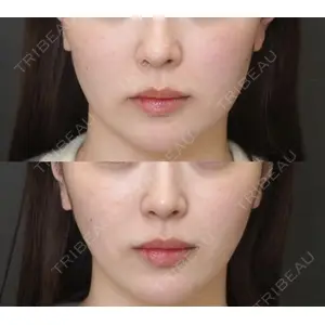 しんゆり美容健康クリニックの症例