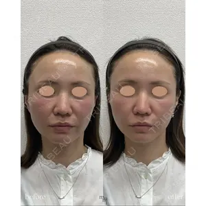 muni skin clinic 高麗 惠理医師の症例