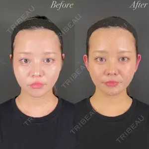 R Beauty CLINIC 名古屋院 木村 尚大医師の症例