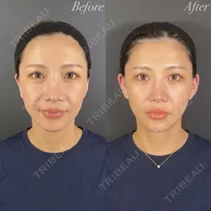 R Beauty CLINIC 名古屋院 木村 尚大医師の症例