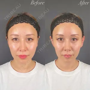 R Beauty CLINIC 名古屋院 木村 尚大医師の症例