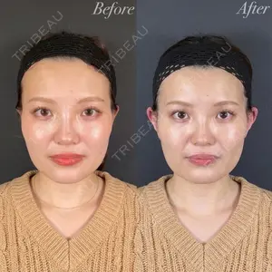 R Beauty CLINIC 名古屋院 木村 尚大医師の症例