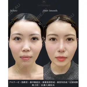 La Clinique Osaka 【ラクリニック大阪】 長瀬 ⼤蔵医師の症例