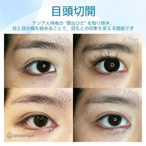 聖心美容クリニック 札幌院 前多 一彦医師の症例