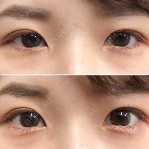 しのぶ皮膚科 蘇原しのぶ医師の症例