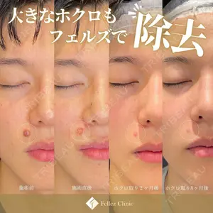 Fellez Clinic【フェルズクリニック】の症例