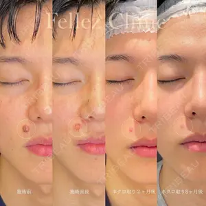 Fellez Clinic【フェルズクリニック】の症例