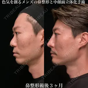 Zetith Beauty Clinic 銀座院 鉄 鑠医師の症例