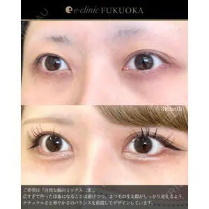 eクリニック 福岡院 伊藤 渉医師の症例