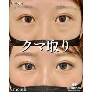 Brandnew Beauty Clinic 平山 容成医師の症例
