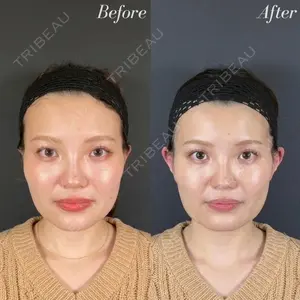 R Beauty CLINIC 名古屋院 木村 尚大医師の症例