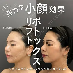 ロレシー美容クリニック 心斎橋駅前院 福留院長医師の症例