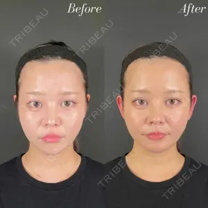 R Beauty CLINIC 名古屋院 木村 尚大医師の症例
