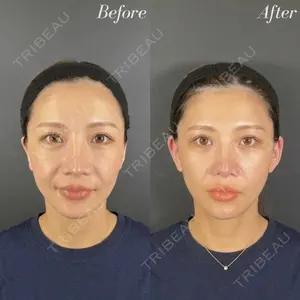 R Beauty CLINIC 名古屋院 木村 尚大医師の症例