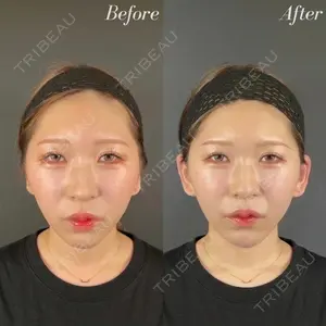 R Beauty CLINIC 名古屋院 木村 尚大医師の症例