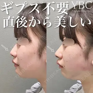 YBC横浜美容外科 池袋院 磯村 亮輔医師の症例