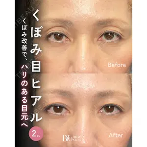 BITO BEAUTY CLINIC 伊藤 富良野医師の症例
