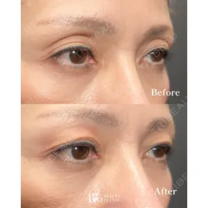 BITO BEAUTY CLINIC 伊藤 富良野医師の症例
