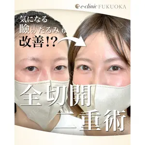 eクリニック 福岡院 伊藤 渉医師の症例