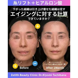 Zetith Beauty Clinic 銀座院 橘　澄医師の症例