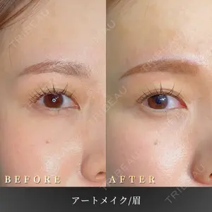BiBiクリニックの症例
