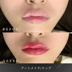 BiBiクリニックの症例
