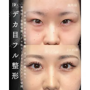 BITO BEAUTY CLINIC 伊藤 富良野医師の症例