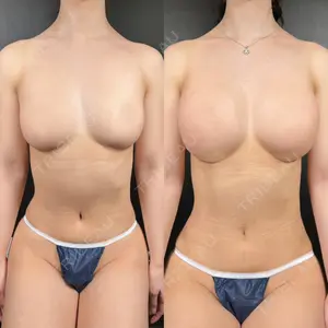 R Beauty CLINIC 銀座院の症例